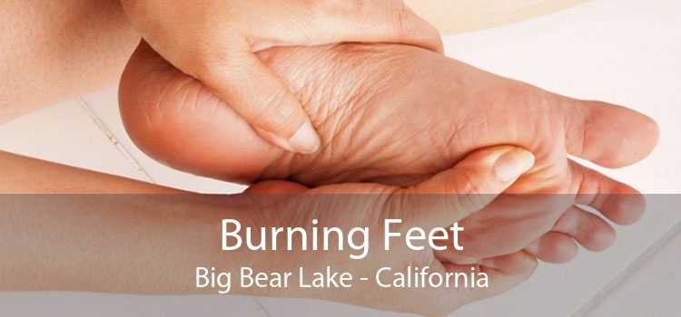 Burning Feet Big Bear Lake - California