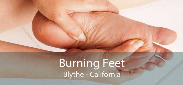 Burning Feet Blythe - California