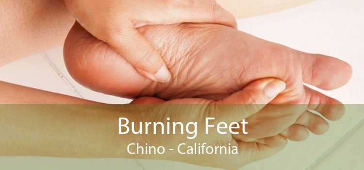 Burning Feet Chino - California