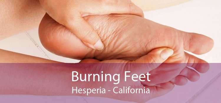Burning Feet Hesperia - California