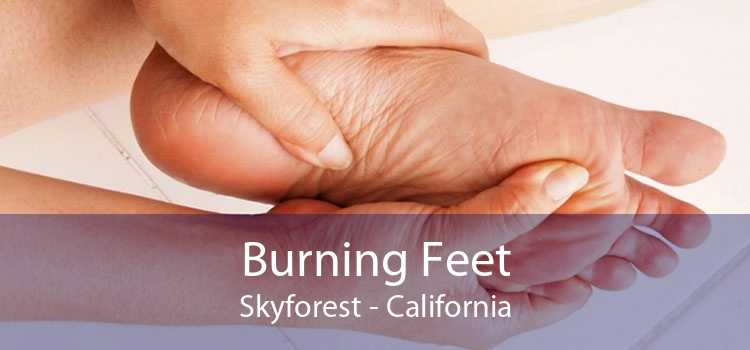 Burning Feet Skyforest - California