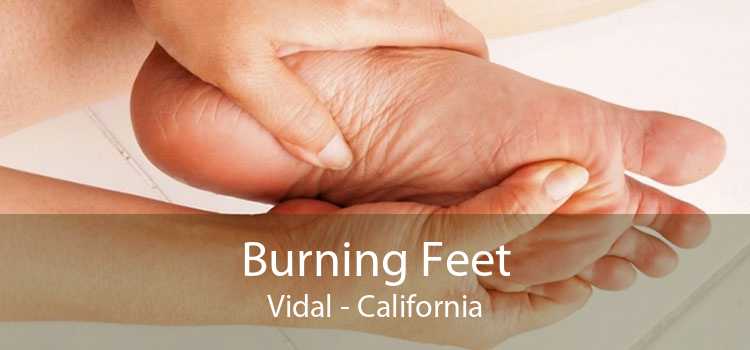Burning Feet Vidal - California