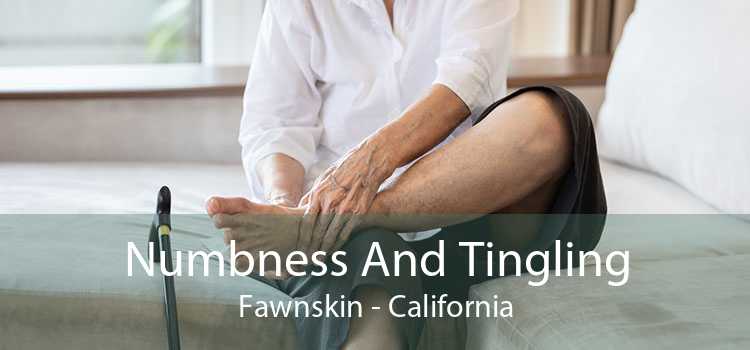Numbness And Tingling Fawnskin - California